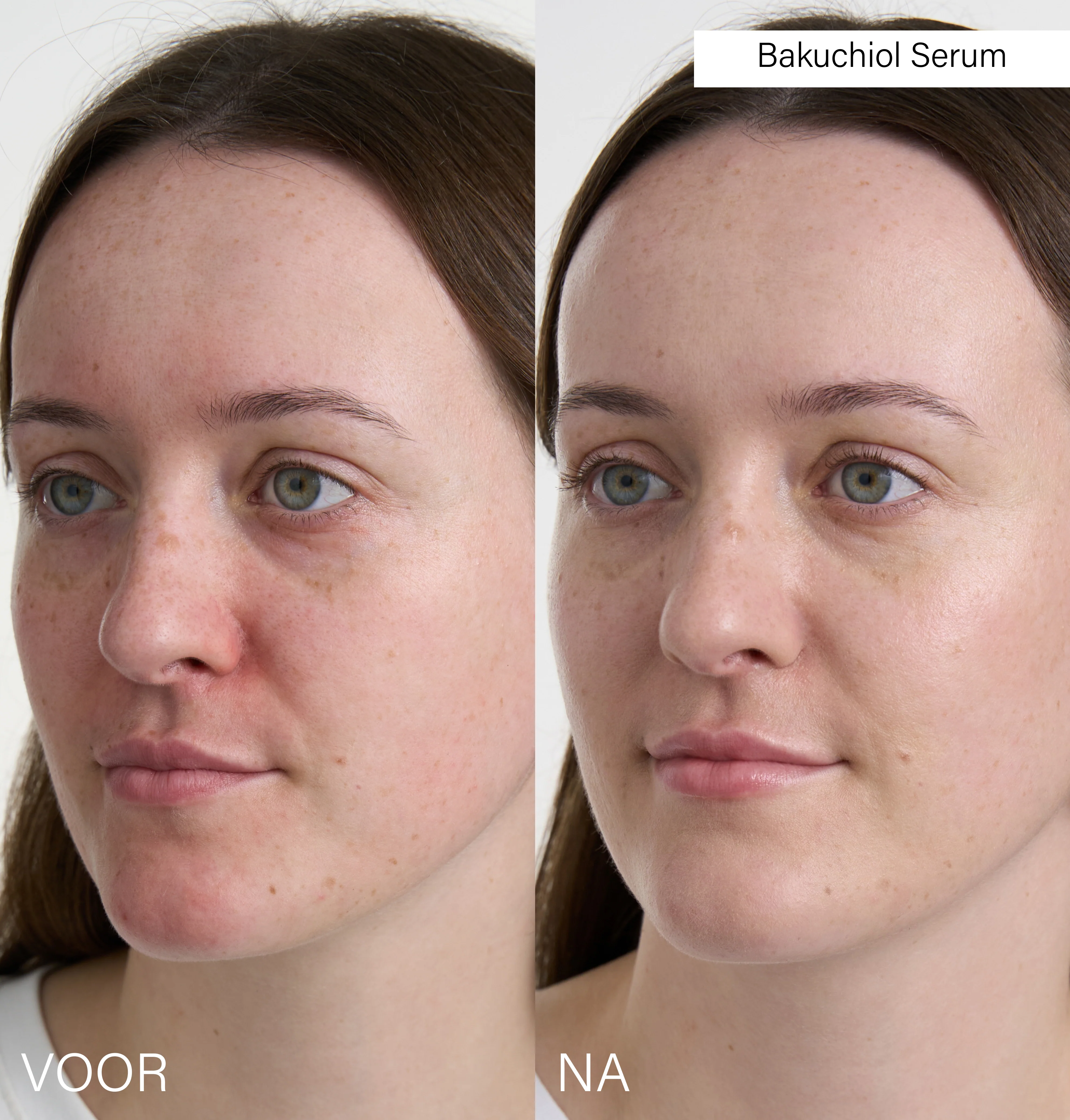 Bakuchiol Serum - Image 3